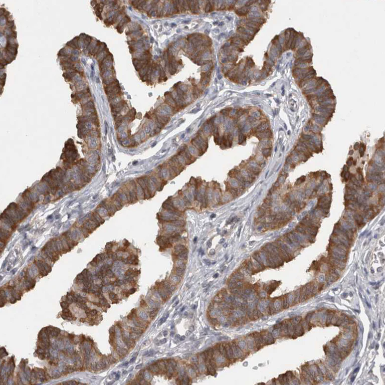 Immunohistochemistry (Formalin/PFA-fixed paraffin-embedded sections) - Anti-SAMD12 antibody (AB121831)