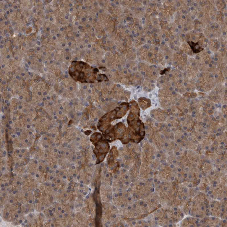 Immunohistochemistry (Formalin/PFA-fixed paraffin-embedded sections) - Anti-SAMD12 antibody (AB121831)