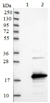 Western blot - Anti-SAMD12 antibody (AB121831)