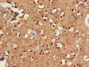 Immunohistochemistry (Formalin/PFA-fixed paraffin-embedded sections) - Anti-SAMD8 antibody (AB234679)