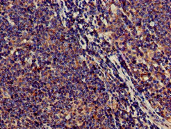 Immunohistochemistry (Formalin/PFA-fixed paraffin-embedded sections) - Anti-SAMD8 antibody (AB234679)