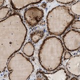 Immunohistochemistry (Formalin/PFA-fixed paraffin-embedded sections) - Anti-SAMD9 antibody (AB121663)