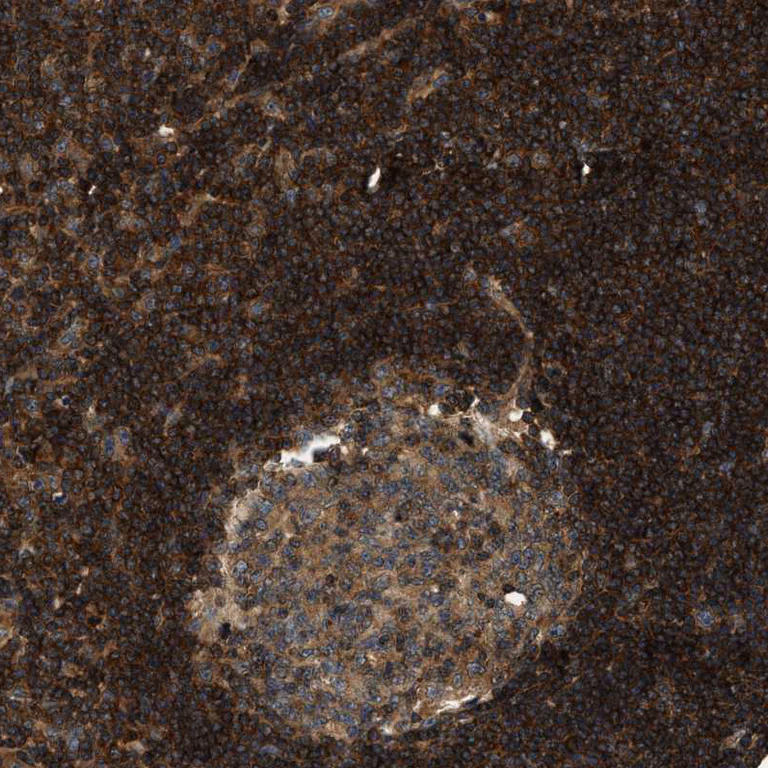 Immunohistochemistry (Formalin/PFA-fixed paraffin-embedded sections) - Anti-SAMD9 antibody (AB121664)