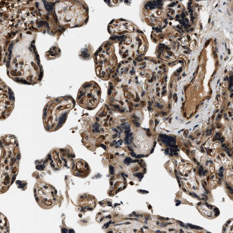 Immunohistochemistry (Formalin/PFA-fixed paraffin-embedded sections) - Anti-SAMD9 antibody (AB121664)