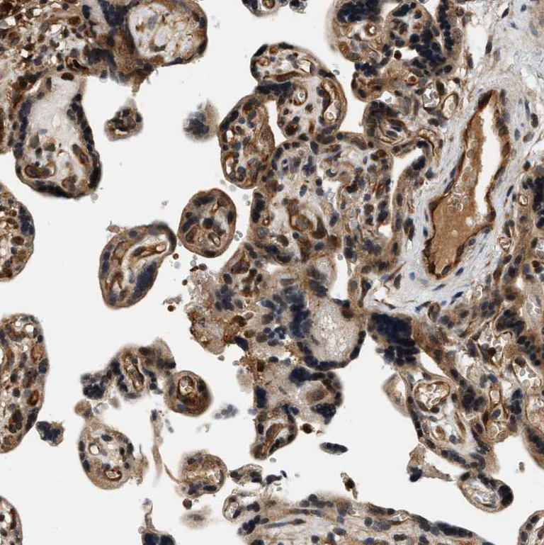 Immunohistochemistry (Formalin/PFA-fixed paraffin-embedded sections) - Anti-SAMD9 antibody (AB121664)
