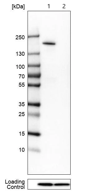Western blot - Anti-SAMD9 antibody (AB121664)