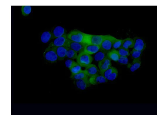 Immunocytochemistry/ Immunofluorescence - Anti-SAMD9 antibody [EPR13603] (AB180575)