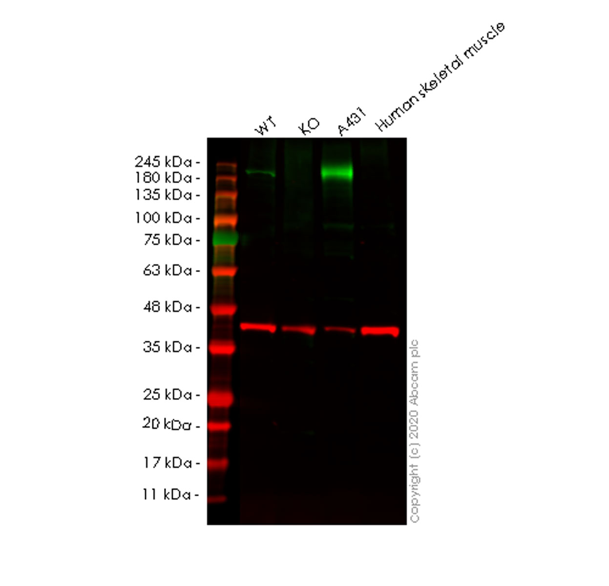 Western blot - Anti-SAMD9 antibody [EPR13603] (AB180575), expandable thumbnail
