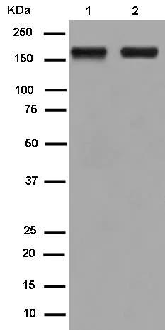 Western blot - Anti-SAMD9 antibody [EPR13603] (AB180575)