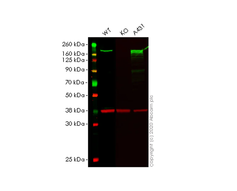 Western blot - Anti-SAMD9 antibody [EPR13603] - BSA and Azide free (AB250226)