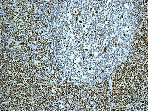 Immunohistochemistry (Formalin/PFA-fixed paraffin-embedded sections) - Anti-SAMHD1 antibody [EPR13040(B)] - C-terminal (AB177462)