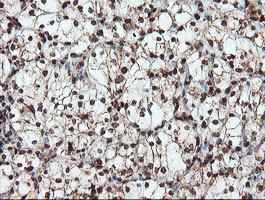Immunohistochemistry (Formalin/PFA-fixed paraffin-embedded sections) - Anti-SAMHD1 antibody [OTI1A1] (AB128107)