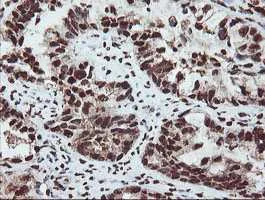 Immunohistochemistry (Formalin/PFA-fixed paraffin-embedded sections) - Anti-SAMHD1 antibody [OTI1A1] (AB128107)