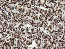 Immunohistochemistry (Formalin/PFA-fixed paraffin-embedded sections) - Anti-SAMHD1 antibody [OTI1A1] (AB128107)