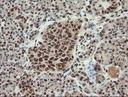 Immunohistochemistry (Formalin/PFA-fixed paraffin-embedded sections) - Anti-SAMHD1 antibody [OTI1A1] (AB128107)