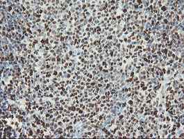 Immunohistochemistry (Formalin/PFA-fixed paraffin-embedded sections) - Anti-SAMHD1 antibody [OTI1A1] (AB128107)