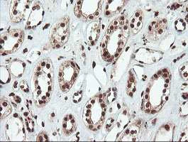 Immunohistochemistry (Formalin/PFA-fixed paraffin-embedded sections) - Anti-SAMHD1 antibody [OTI1A1] (AB128107)