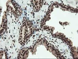 Immunohistochemistry (Formalin/PFA-fixed paraffin-embedded sections) - Anti-SAMHD1 antibody [OTI1A1] (AB128107)