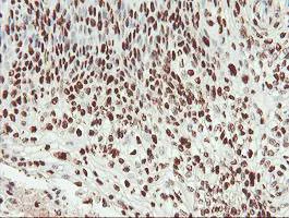 Immunohistochemistry (Formalin/PFA-fixed paraffin-embedded sections) - Anti-SAMHD1 antibody [OTI1A1] (AB128107)