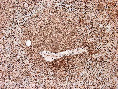 Immunohistochemistry (Formalin/PFA-fixed paraffin-embedded sections) - Anti-SAMHD1 antibody [OTI1F9] (AB117908)