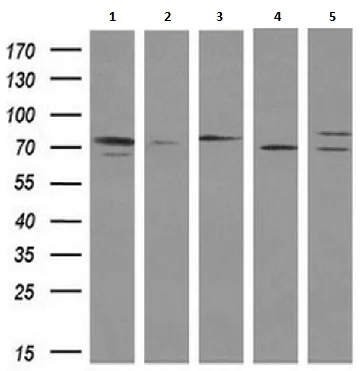 Western blot - Anti-SAMHD1 antibody [OTI1F9] (AB117908)