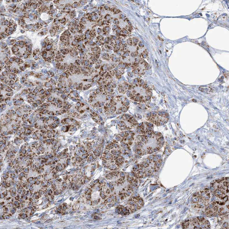 Immunohistochemistry (Formalin/PFA-fixed paraffin-embedded sections) - Anti-SAMM50/SAM50 antibody (AB246987)