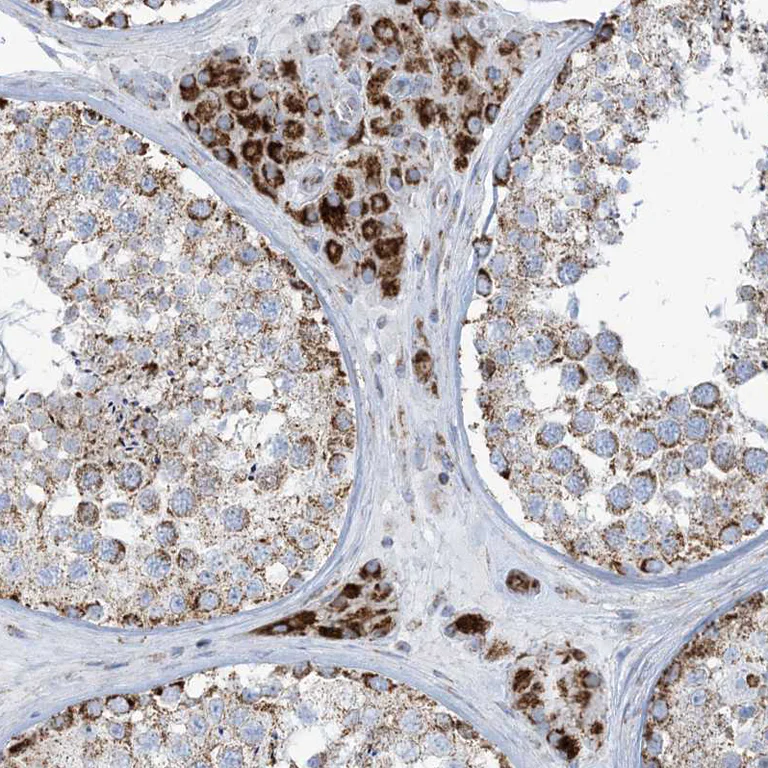 Immunohistochemistry (Formalin/PFA-fixed paraffin-embedded sections) - Anti-SAMM50/SAM50 antibody (AB246987)