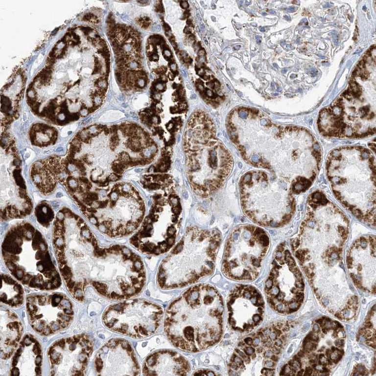 Immunohistochemistry (Formalin/PFA-fixed paraffin-embedded sections) - Anti-SAMM50/SAM50 antibody (AB246987)