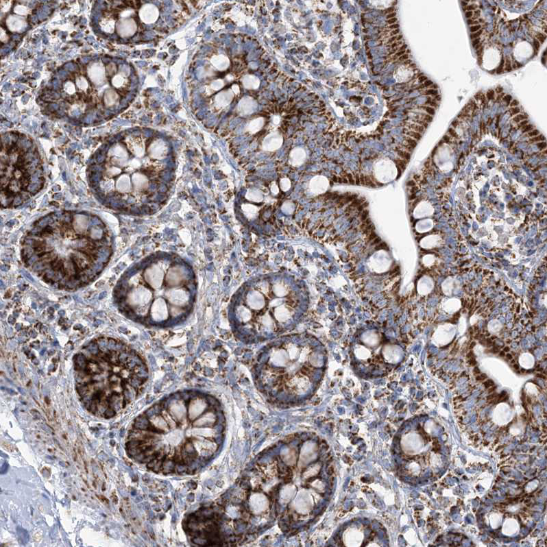 Immunohistochemistry (Formalin/PFA-fixed paraffin-embedded sections) - Anti-SAMM50/SAM50 antibody (AB246987)