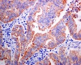 Immunohistochemistry (Formalin/PFA-fixed paraffin-embedded sections) - Anti-SAMM50/SAM50 antibody [EPR8718] (AB133709), expandable thumbnail