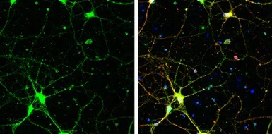Immunocytochemistry/ Immunofluorescence - Anti-SAP102 antibody (AB152132)