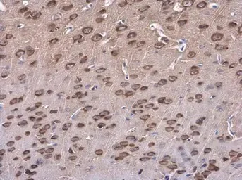 Immunohistochemistry (Formalin/PFA-fixed paraffin-embedded sections) - Anti-SAP102 antibody (AB152132)