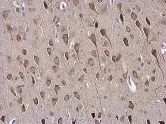Immunohistochemistry (Formalin/PFA-fixed paraffin-embedded sections) - Anti-SAP102 antibody (AB152132)