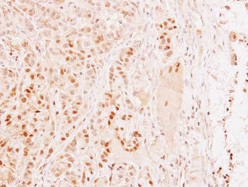 Immunohistochemistry (Formalin/PFA-fixed paraffin-embedded sections) - Anti-SAP102 antibody (AB152132), expandable thumbnail