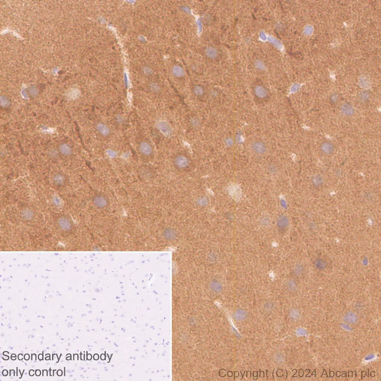 Immunohistochemistry (Formalin/PFA-fixed paraffin-embedded sections) - Anti-SAP102 antibody [EPR28704-52] (AB316858)