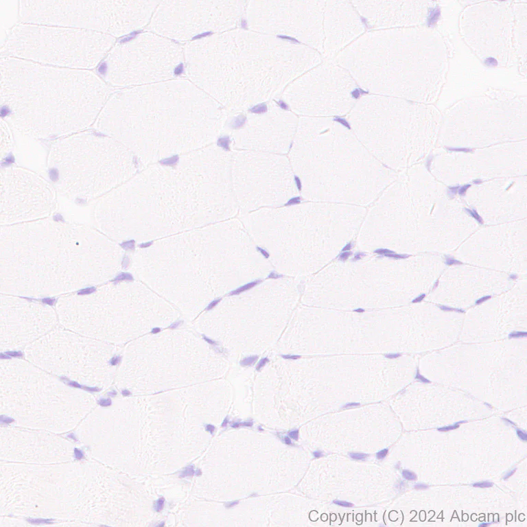 Immunohistochemistry (Formalin/PFA-fixed paraffin-embedded sections) - Anti-SAP102 antibody [EPR28704-52] (AB316858)