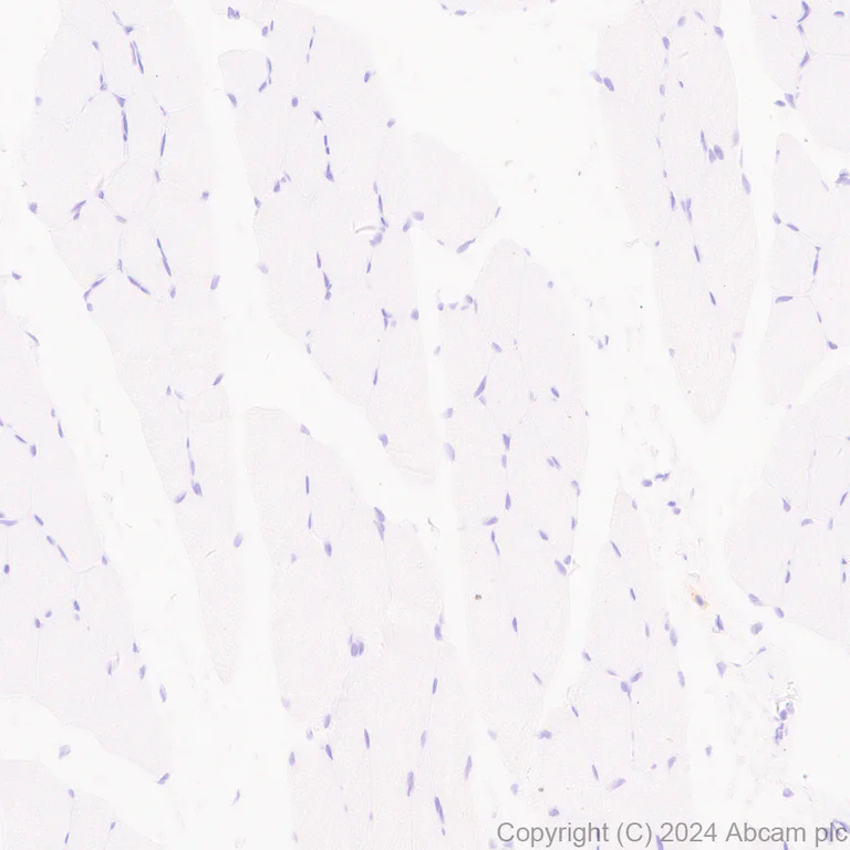 Immunohistochemistry (Formalin/PFA-fixed paraffin-embedded sections) - Anti-SAP102 antibody [EPR28704-52] (AB316858)