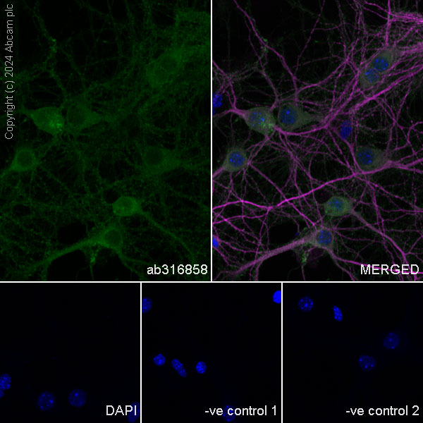 Immunocytochemistry/ Immunofluorescence - Anti-SAP102 antibody [EPR28704-52] - BSA and Azide free (AB316859), expandable thumbnail