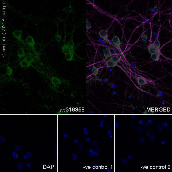 Immunocytochemistry/ Immunofluorescence - Anti-SAP102 antibody [EPR28704-52] - BSA and Azide free (AB316859), expandable thumbnail