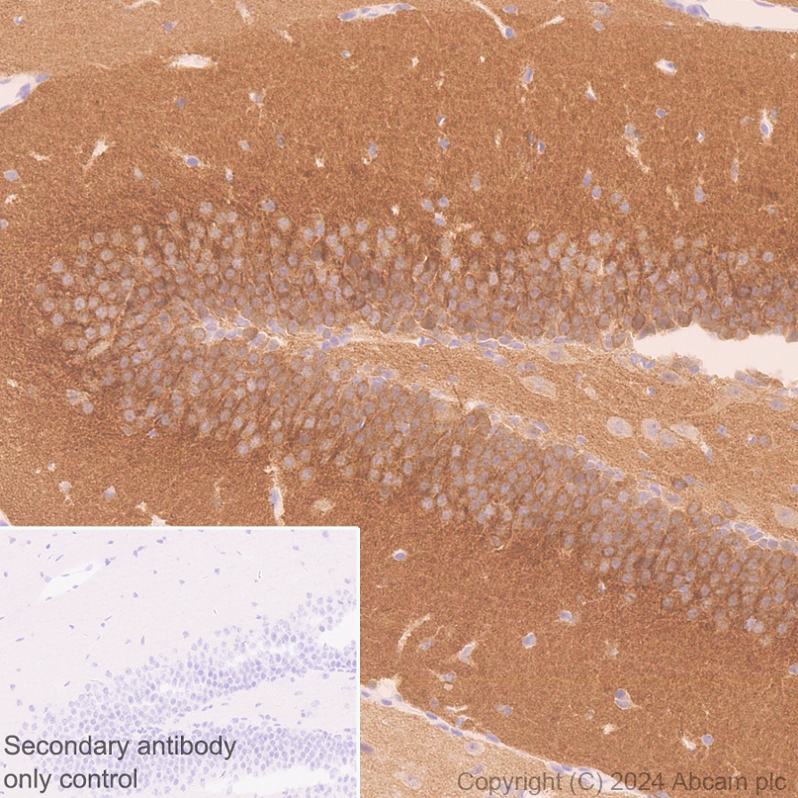 Immunohistochemistry (Formalin/PFA-fixed paraffin-embedded sections) - Anti-SAP102 antibody [EPR28704-52] - BSA and Azide free (ab316859), expandable thumbnail