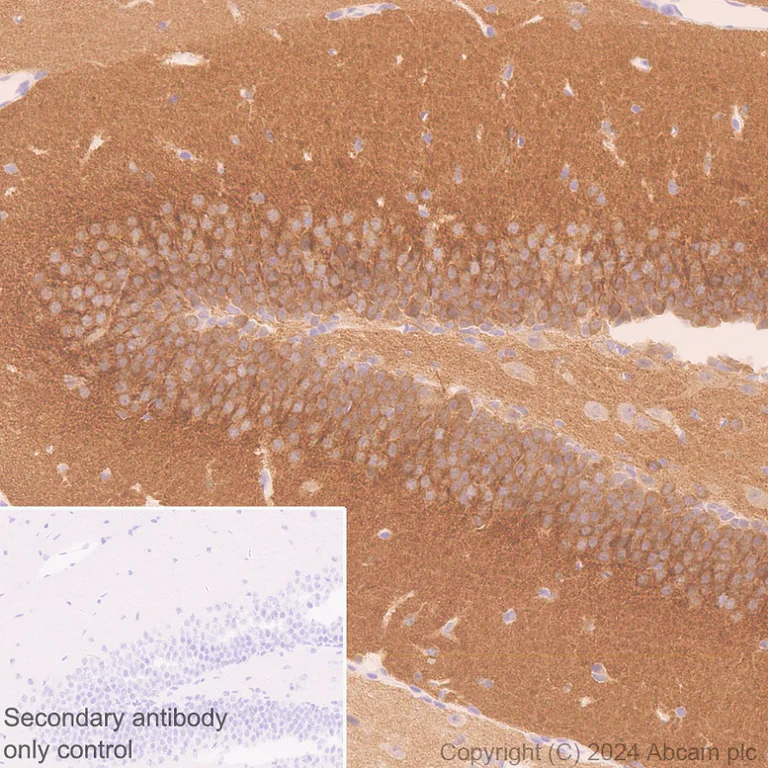 Immunohistochemistry (Formalin/PFA-fixed paraffin-embedded sections) - Anti-SAP102 antibody [EPR28704-52] - BSA and Azide free (AB316859)
