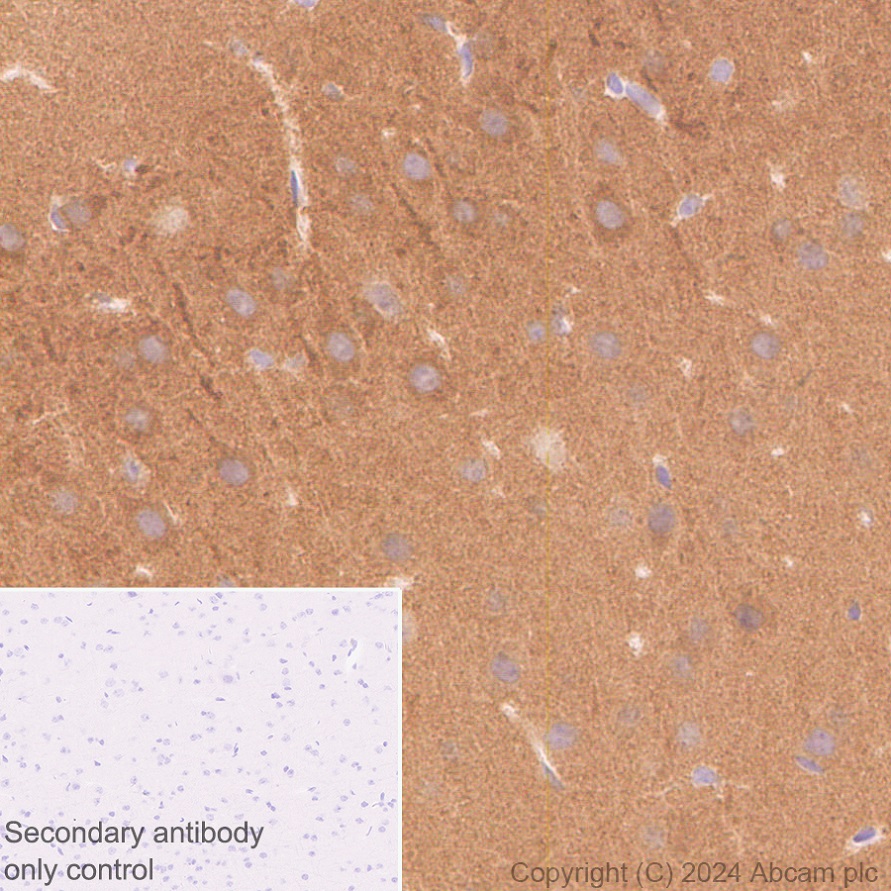 Immunohistochemistry (Formalin/PFA-fixed paraffin-embedded sections) - Anti-SAP102 antibody [EPR28704-52] - BSA and Azide free (ab316859), expandable thumbnail