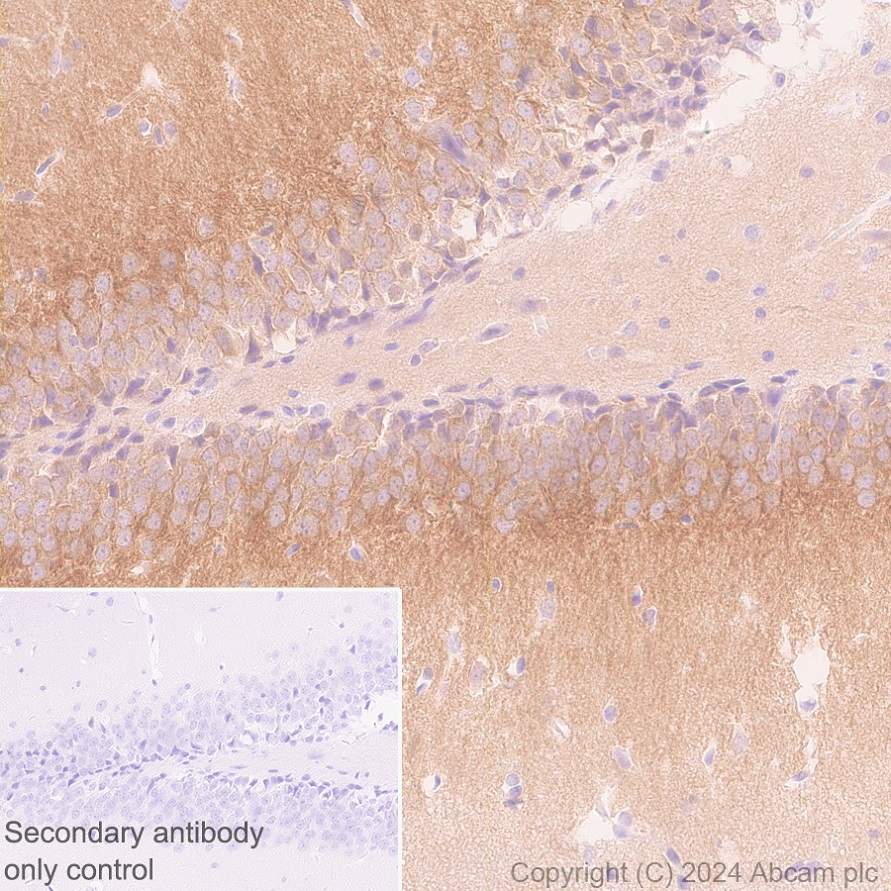 Immunohistochemistry (Formalin/PFA-fixed paraffin-embedded sections) - Anti-SAP102 antibody [EPR28704-52] - BSA and Azide free (ab316859), expandable thumbnail