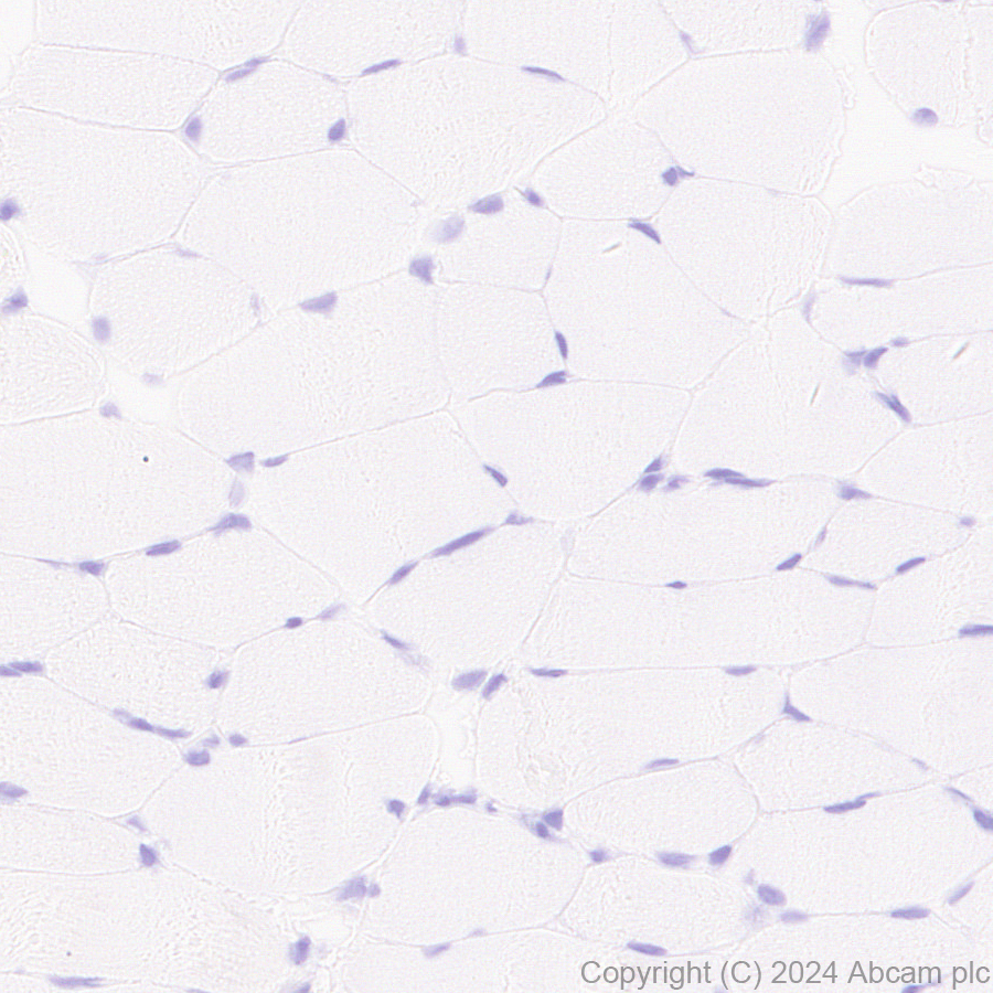 Immunohistochemistry (Formalin/PFA-fixed paraffin-embedded sections) - Anti-SAP102 antibody [EPR28704-52] - BSA and Azide free (ab316859), expandable thumbnail