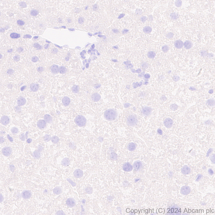 Immunohistochemistry (Formalin/PFA-fixed paraffin-embedded sections) - Anti-SAP102 antibody [EPR28704-52] - BSA and Azide free (ab316859), expandable thumbnail