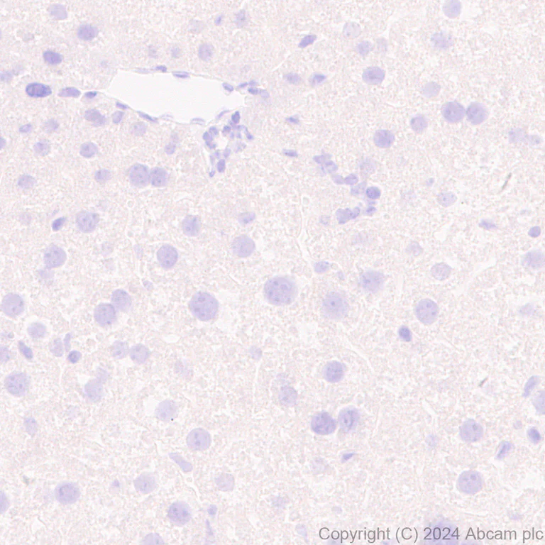 Immunohistochemistry (Formalin/PFA-fixed paraffin-embedded sections) - Anti-SAP102 antibody [EPR28704-52] - BSA and Azide free (AB316859)
