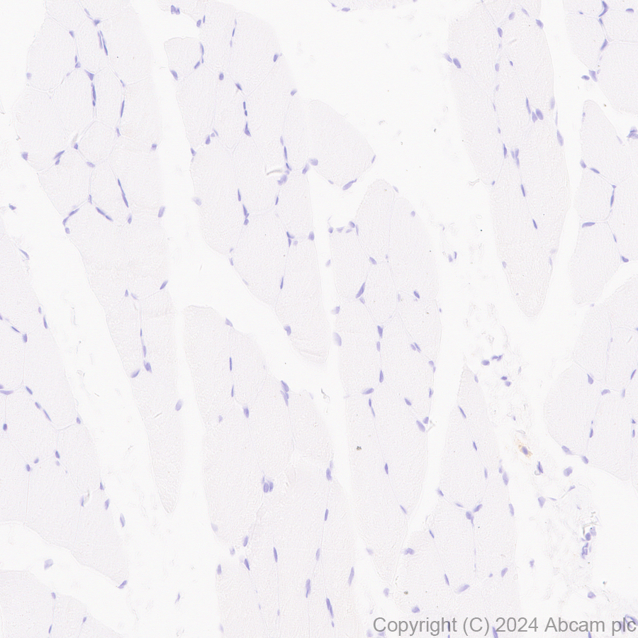 Immunohistochemistry (Formalin/PFA-fixed paraffin-embedded sections) - Anti-SAP102 antibody [EPR28704-52] - BSA and Azide free (ab316859), expandable thumbnail