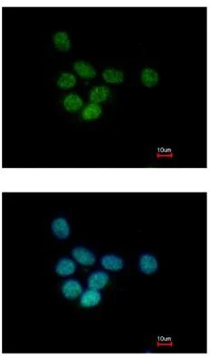 Immunocytochemistry/ Immunofluorescence - Anti-SAP130 antibody (AB111739)