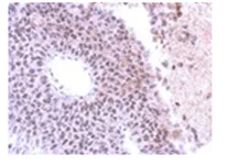 Immunohistochemistry (Formalin/PFA-fixed paraffin-embedded sections) - Anti-SAP130 antibody (AB111739)