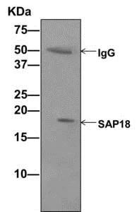 Immunoprecipitation - Anti-SAP18 antibody [EPR12956(B)] (AB175920)